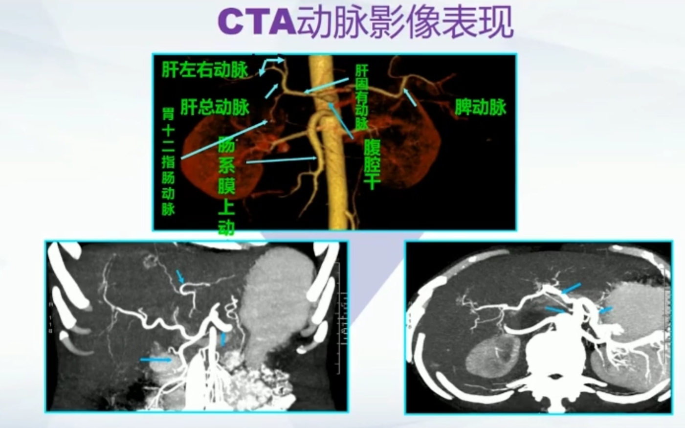 liver-cta-dongmai